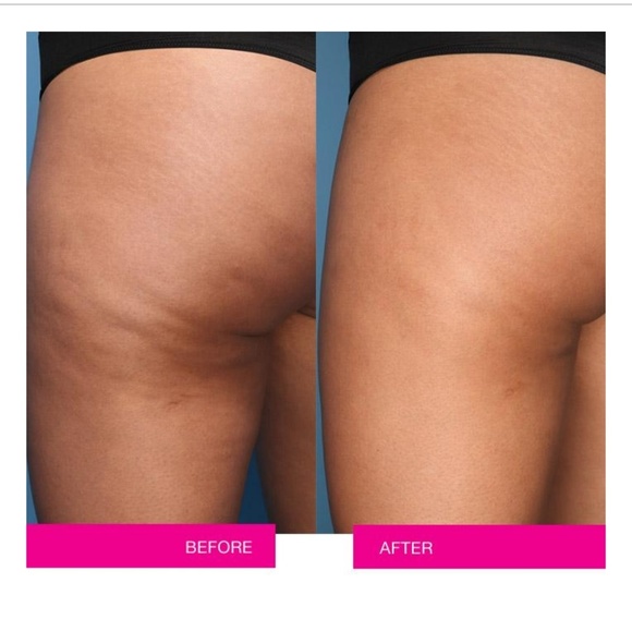 Anti-Cellulite NAKEDPROOF Smooth Moves CoolingGel - Picture 2 of 4